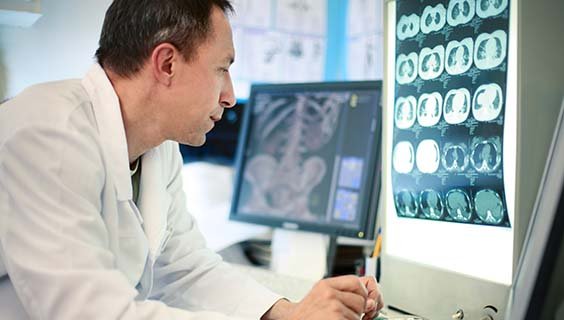 Doctor examining brain scans