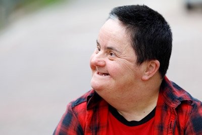 Middle aged adult with Down syndrome